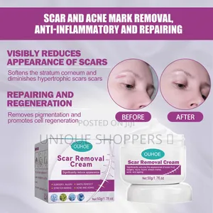 Scar And Acne Remover