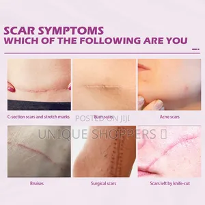 Scar And Acne Remover