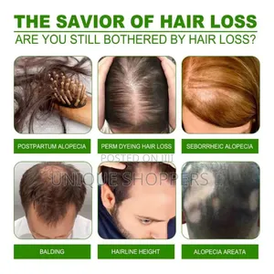 Anti Hair Loss Cream