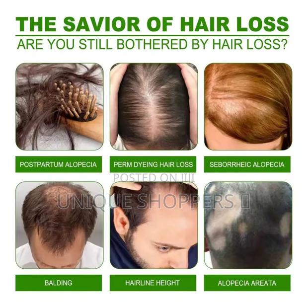 Anti Hair Loss Cream - thumbnail 3