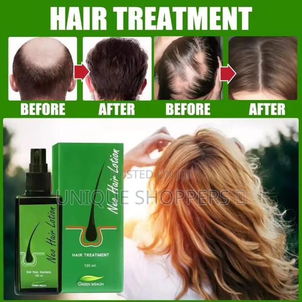 Anti Hair Loss Cream - thumbnail 4