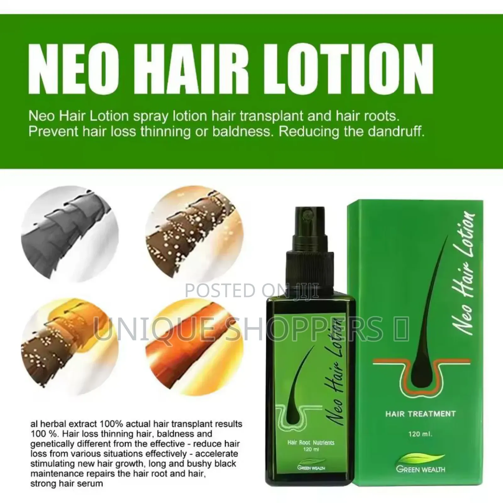 Anti Hair Loss Cream
