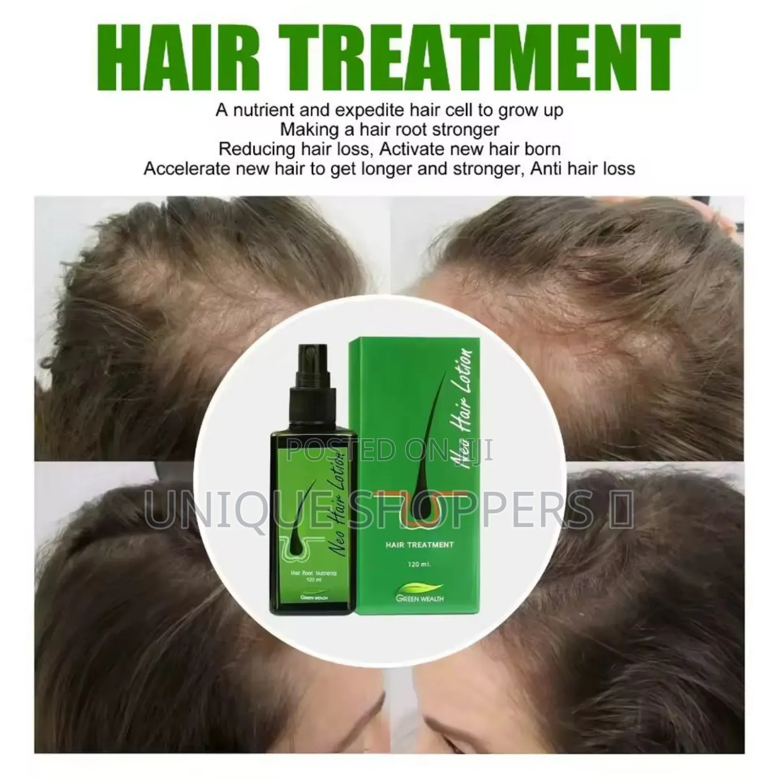 Anti Hair Loss Cream
