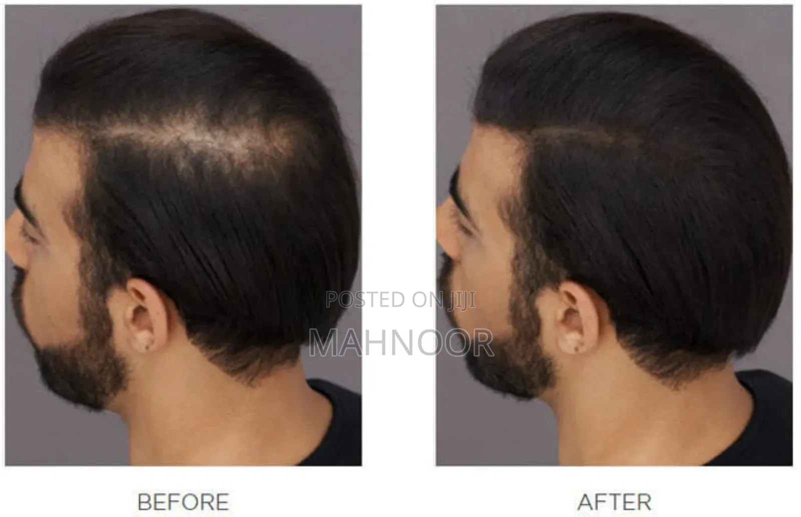 Toppik Hair Perfecting Tool Kit (27.5g + Applicator + Hairline Comb)