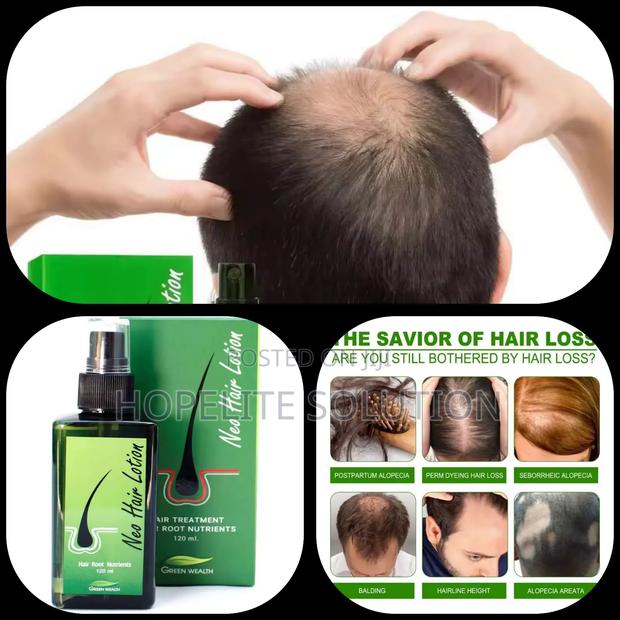 Ant Hair Loss Tonic - main view