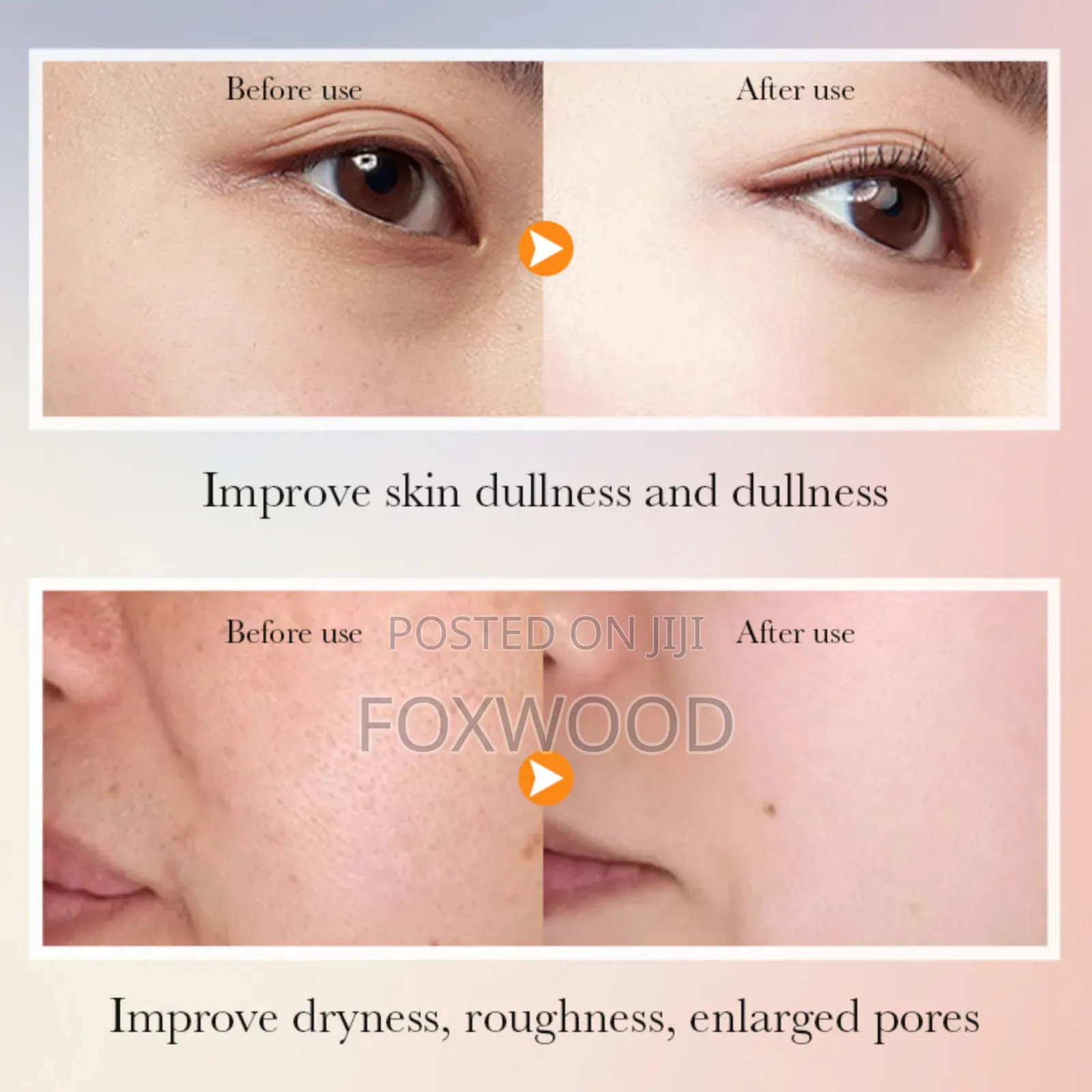 Sadoer 5x Vitamin C Skincare Set 6pc