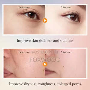 Sadoer 5x Vitamin C Skincare Set 6pc