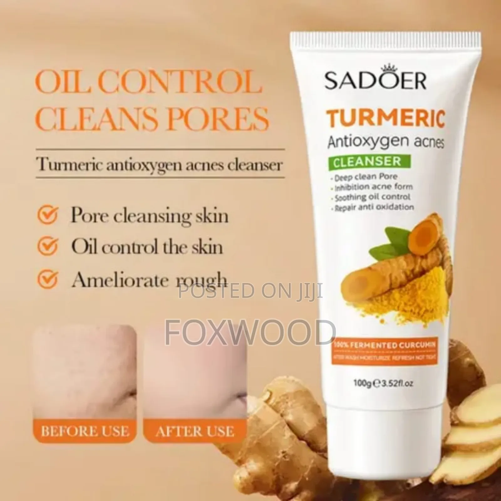 Sadoer 2in1 Tumeric Face Toner and Tumeric Face Cleanser
