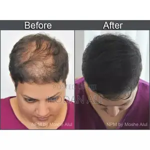 Toppik Hair Fibers Full Set (27.5g/Holdspray/Applicator/Optimizer)