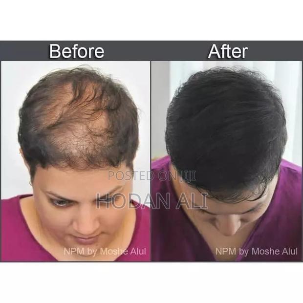 Toppik Hair Fibers Full Set (27.5g/Holdspray/Applicator/Optimizer) - thumbnail 3