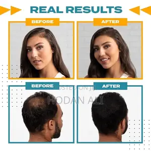 Toppik Hair Fibers Full Set (27.5g/Holdspray/Applicator/Optimizer)
