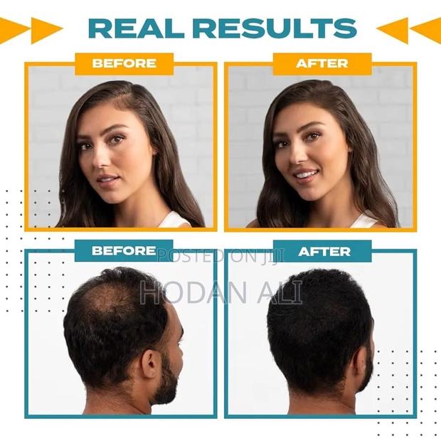 Toppik Hair Fibers Full Set (27.5g/Holdspray/Applicator/Optimizer) - thumbnail 4