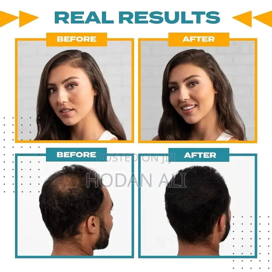 Toppik Hair Fibers Full Set (27.5g/Holdspray/Applicator/Optimizer)
