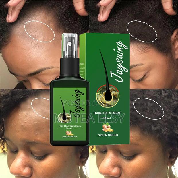 Anti Hair Loss Tonic Hair Treatment Solution