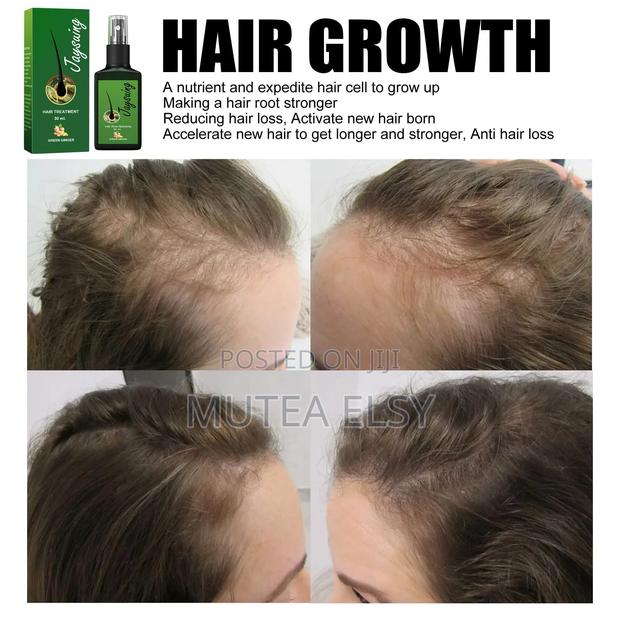 Anti Hair Loss Tonic Hair Treatment Solution - thumbnail 3