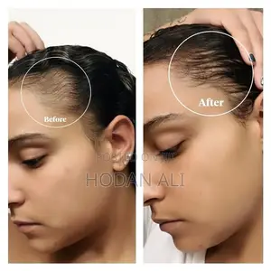 Toppik Hair Building Fiber 27.5g All Colors