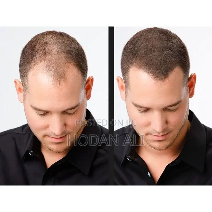Toppik Hair Building Fiber 27.5g All Colors