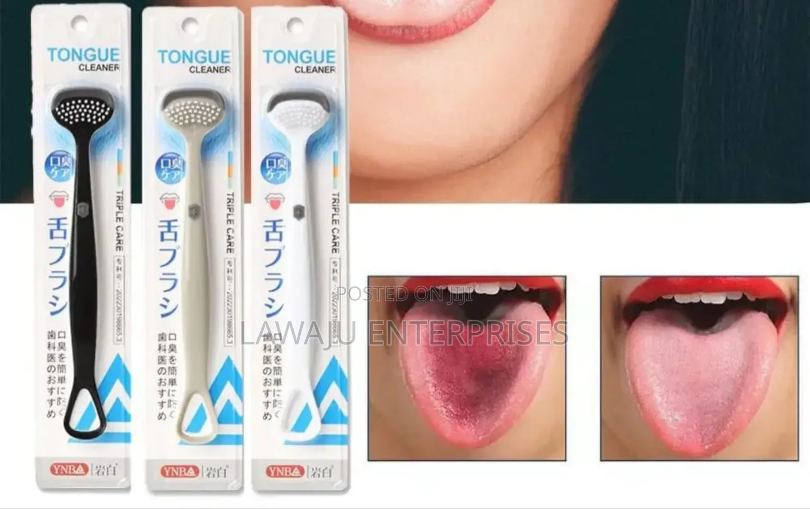 Tongue Cleaner