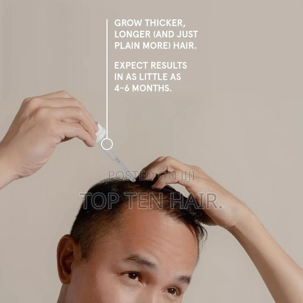 Men Keeps 5% Minoxidil Solution.Hair Loss Treatment. - thumbnail 3