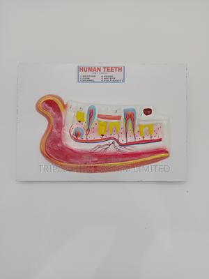 Human Teeth Model - thumbnail 2