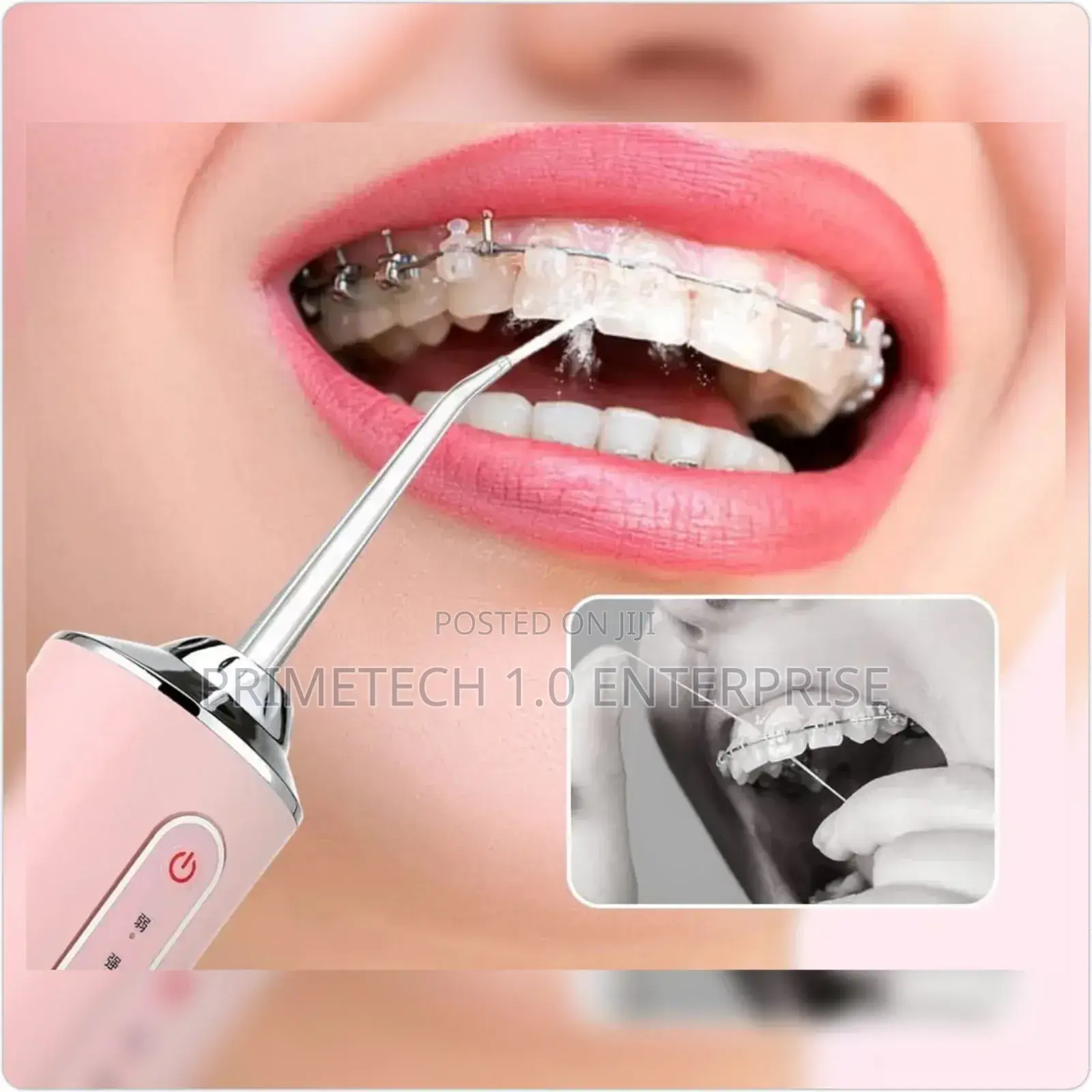 Dental Oral Irrigator