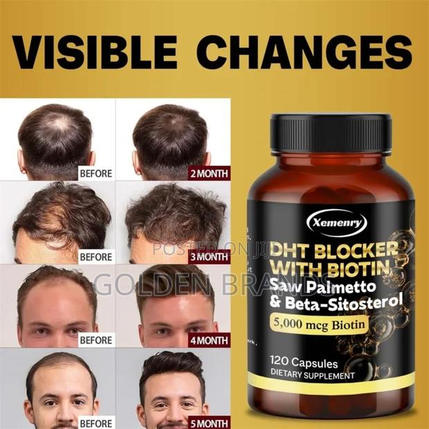 Super Saw Palmetto, Prostate Health, Urinary Tract - DHT Blocker Hair