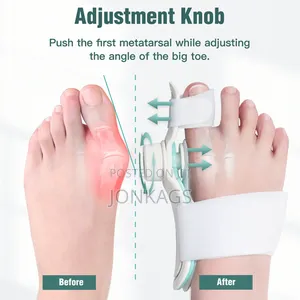 Adjustable Bunion Corrector