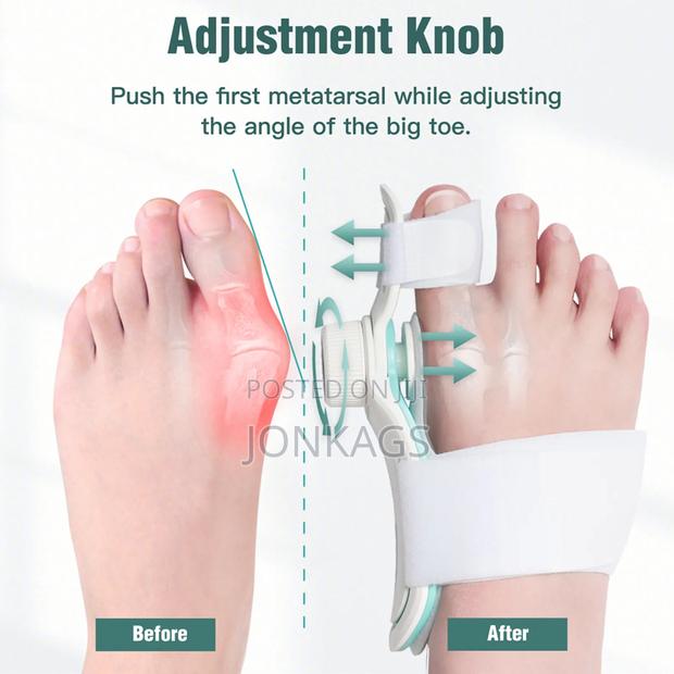 Adjustable Bunion Corrector - thumbnail 5
