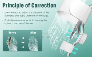 Adjustable Bunion Corrector
