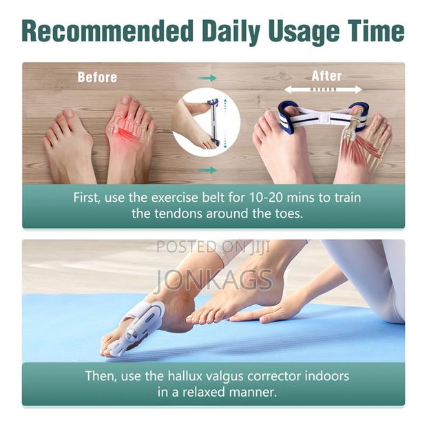 Big Toe Straightener Bunion Hallux Valgus Corrector - thumbnail 7