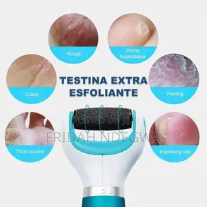 *The Secret Cordless Electric Callus Remover