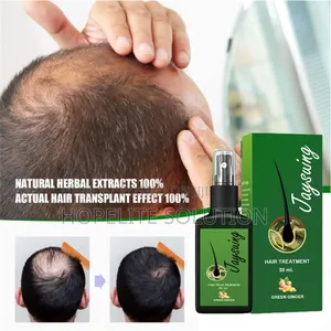 Hair Growth Spray,Ant Hair Loss