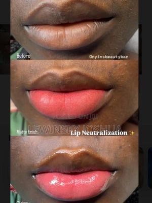 Lightening Lip Cream - thumbnail 2
