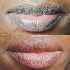 Permanent Pink Lips Therapy - thumbnail 2