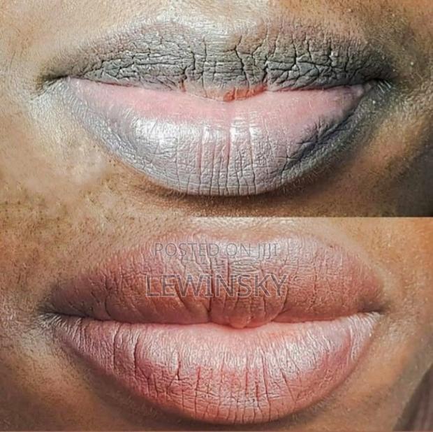 Permanent Pink Lips Therapy - main view