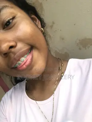 Fashion Braces/Fake Braces