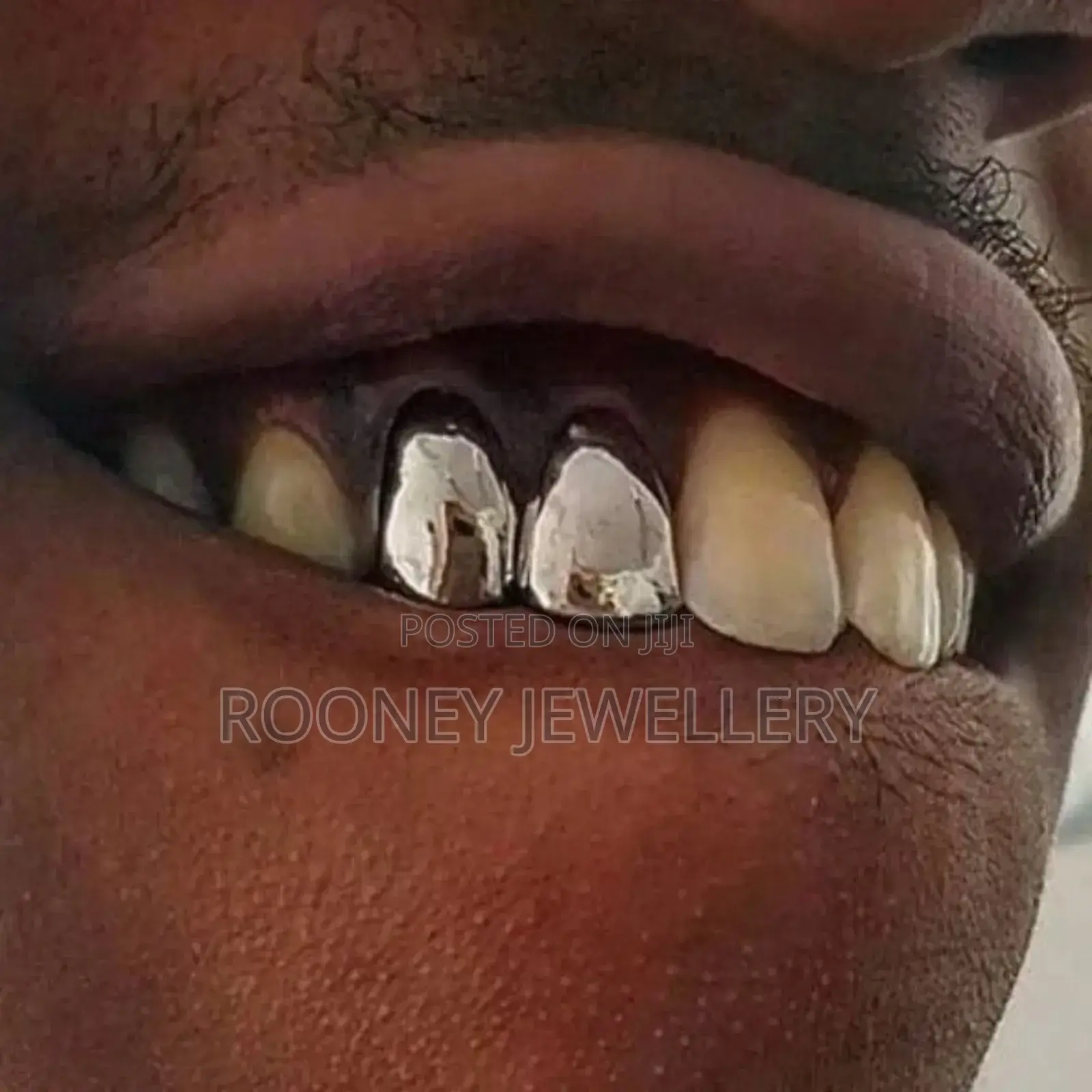 Tattoo and Piercings, Silver Teeth