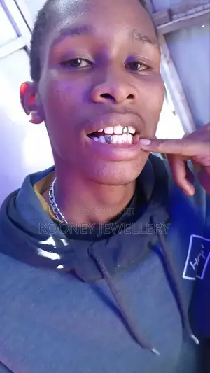 Temporary / Removable Silver Teeth Wholesale and Retail