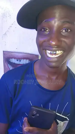 Temporary / Removable Silver Teeth Wholesale and Retail