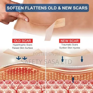 Silicone Scar Sheet