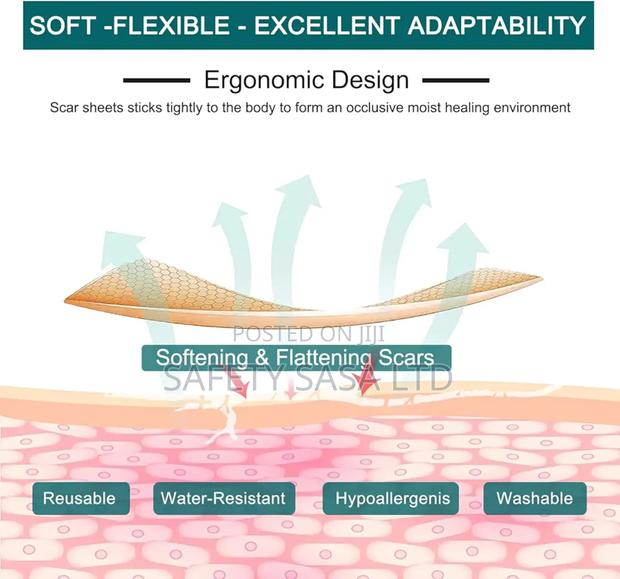 Silicone Scar Sheet - thumbnail 4