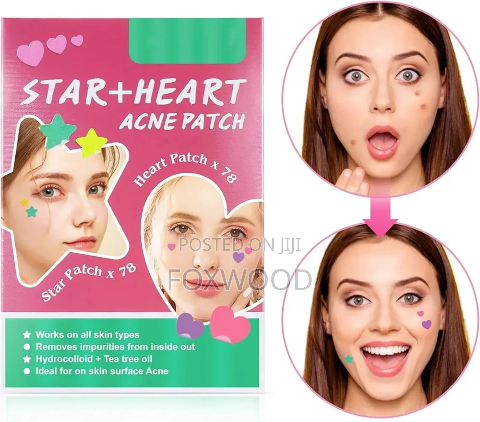 Elaime Star+Heart Acne Patches.