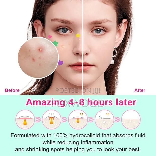 Elaime Star+Heart Acne Patches. - thumbnail 6