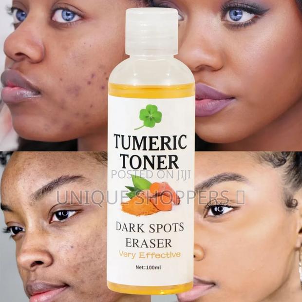 Dark Spots Remover Corrector Serum Tumeric Toner Acne Remover Fade Dar - main view