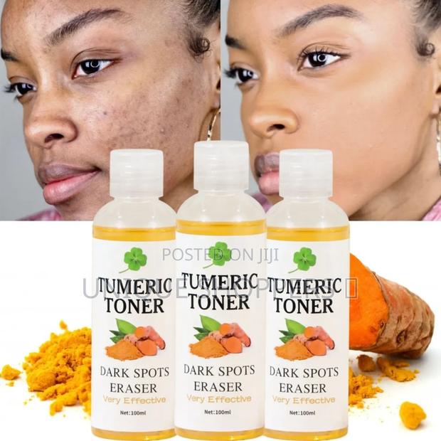 Dark Spots Remover Corrector Serum Tumeric Toner Acne Remover Fade Dar - thumbnail 5