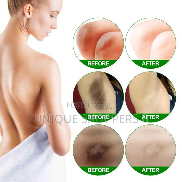 Body Whitening Cream Underarm Knee Buttocks Private Bleach Remove Mela - thumbnail 2