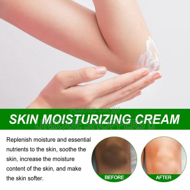 Body Whitening Cream Underarm Knee Buttocks Private Bleach Remove Mela - thumbnail 5