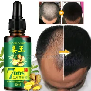 7 Days Germinal Hair Growth Oil Prevent Hair Loss Treatment Oil