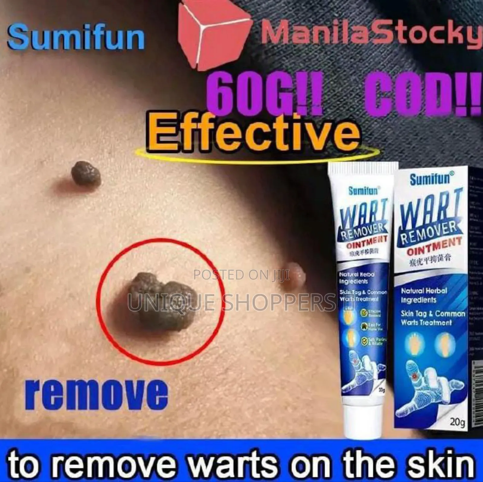 Fast Warts Remover Skin Tag Antibacterial Ointment Wart Treatment