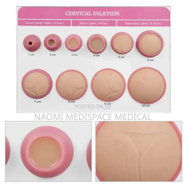Cervical Dilation 10 PCS Set Model/Manikin - main view